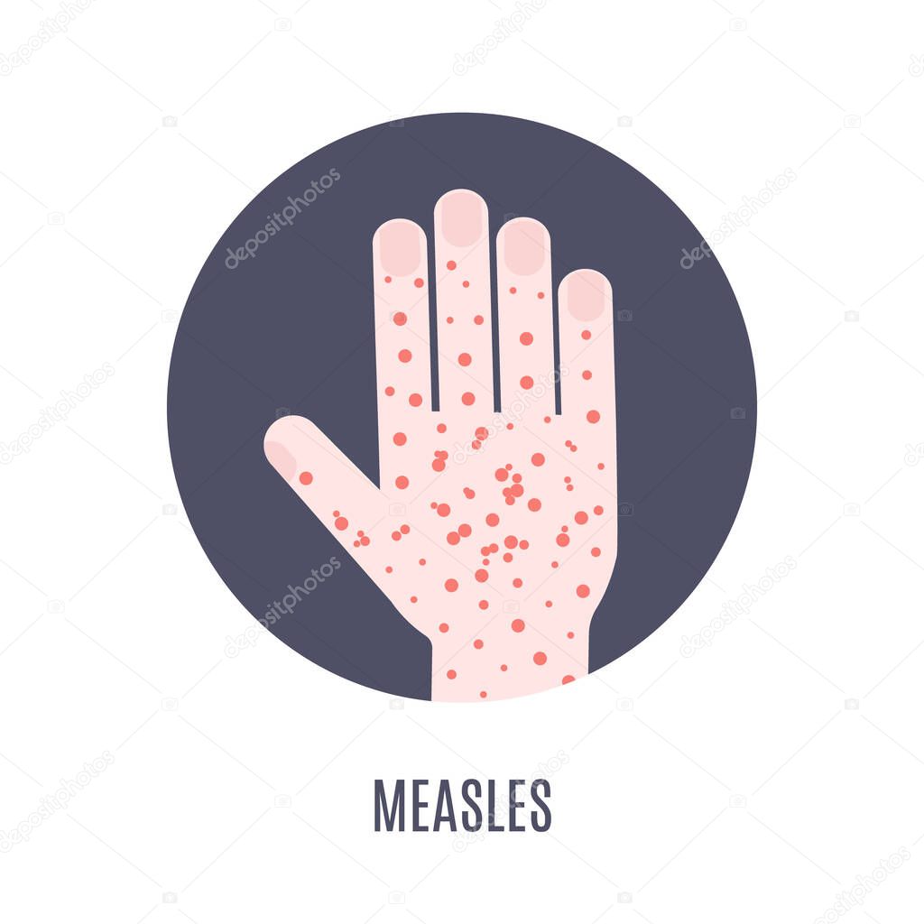 Measles rash on a hand medical icon
