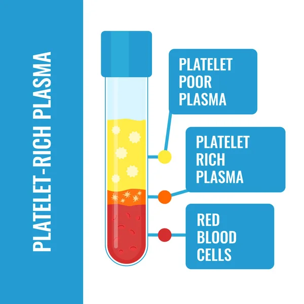 Bloedplaatjes rijke plasma samenstelling medische infographics poster — Stockvector