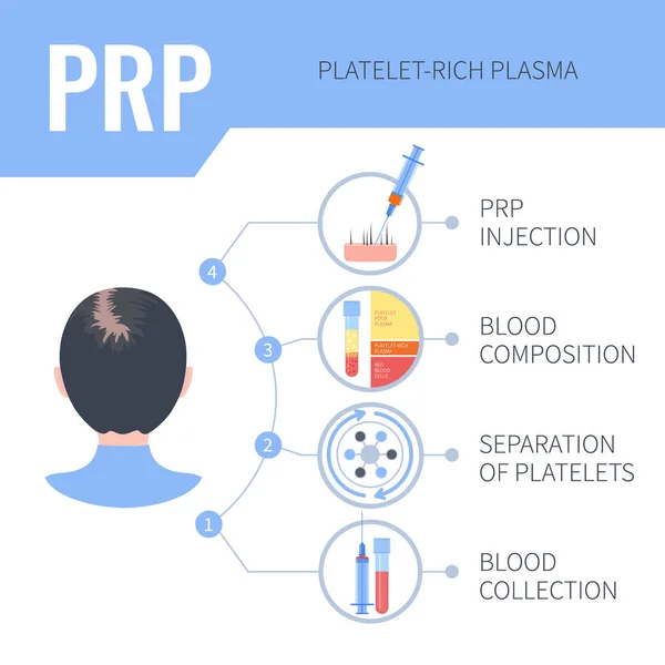 PRP infografías de terapia de regeneración capilar para mujeres — Vector de stock