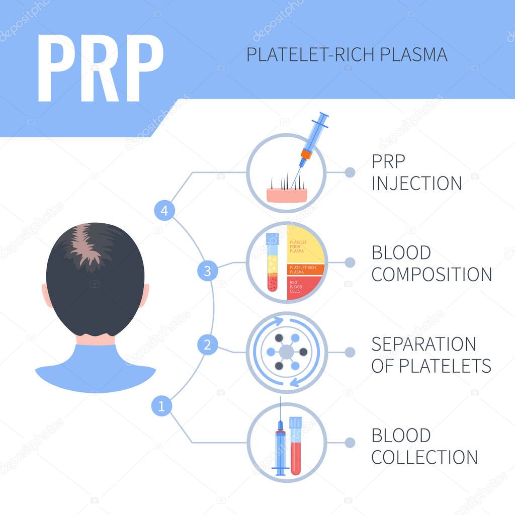 PRP hair regrowth therapy infographics for women