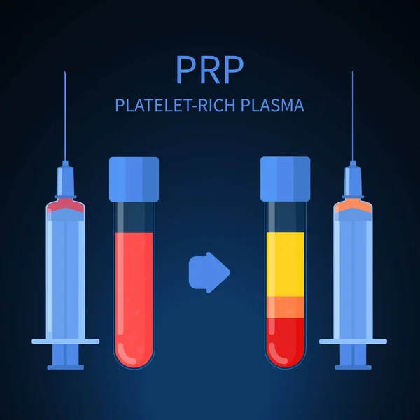 Thrombozytenreiches Plasma-Therapie-Verfahren Infografik Poster — Stockvektor