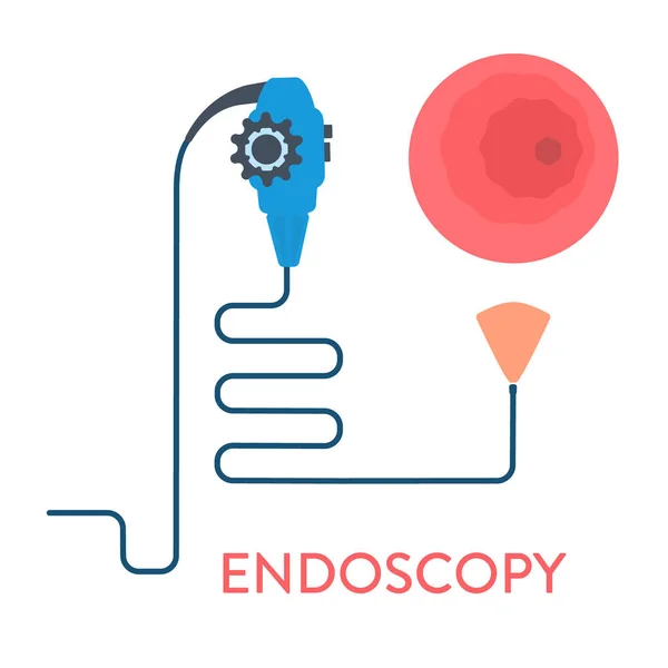 Gastro-scopie procedure van maagonderzoek met endoscoop — Stockvector