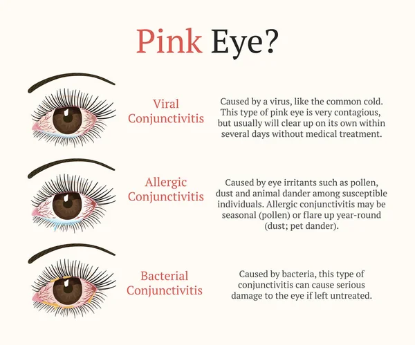 Doença ocular. Oftalmologia ilustração de saúde . —  Vetores de Stock