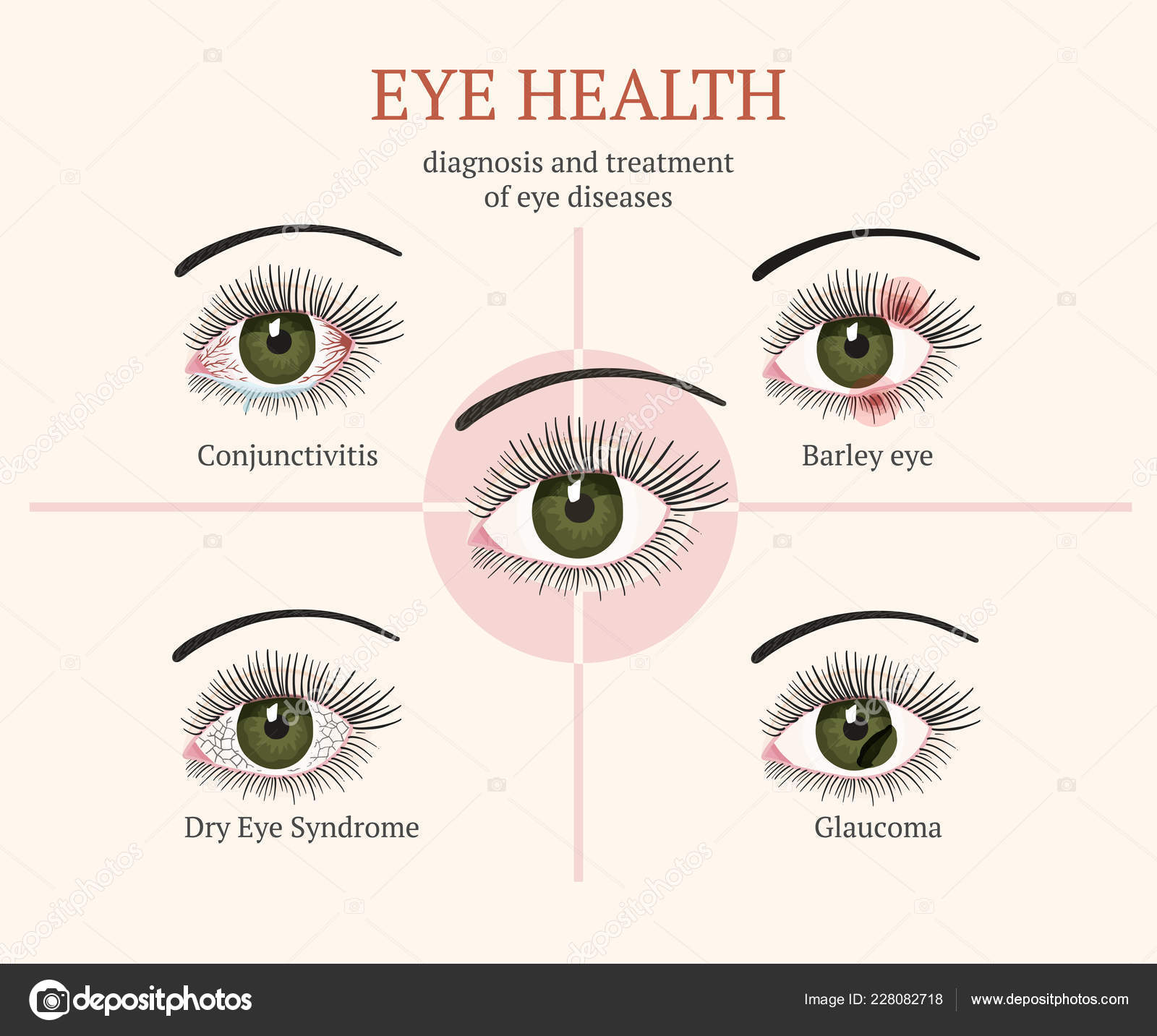 Common Eye Problems - Baptist Health