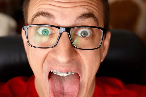 Curved teeth of guy with braces in glasses close up. Portrait of man. Crazy face. Happy expression