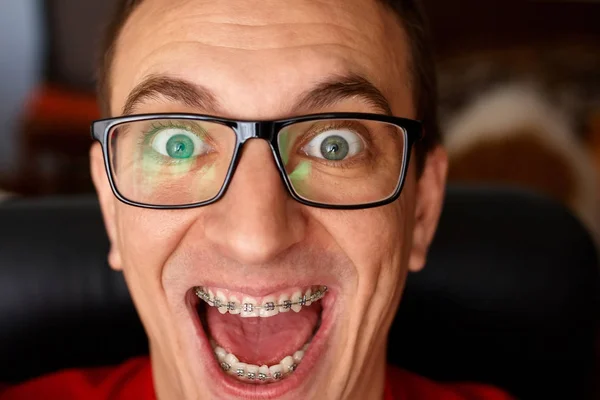 Zakřivené Zuby Chlap Složených Závorek Brýlích Zblízka Portrét Člověka Bláznivé — Stock fotografie
