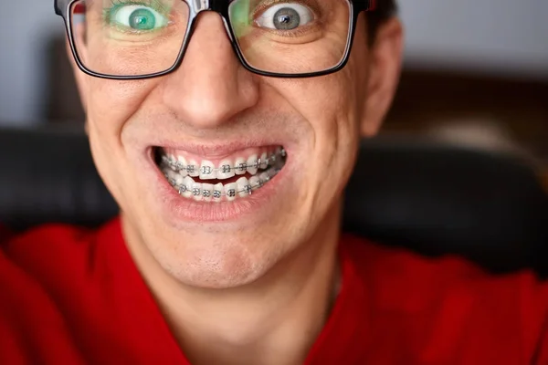 Szalony Twarz Faceta Szelkami Zęby Uśmiechem Okulary Wyrażenie Zadowolony Portret — Zdjęcie stockowe