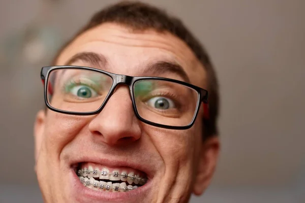 Dentes Curvos Cara Com Aparelho Óculos Perto Retrato Homem Cara — Fotografia de Stock