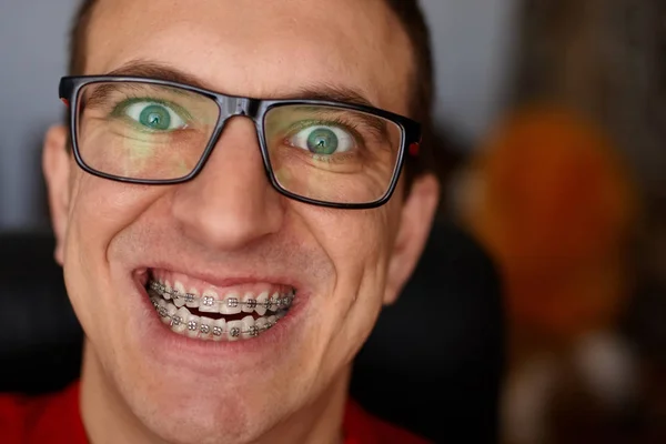Curved Teeth Guy Braces Glasses Close Portrait Man Crazy Face — Stock Photo, Image