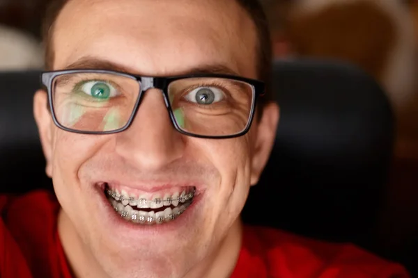 Crazy Face Guy Braces His Teeth Smile Glasses Happy Expression — Stock Photo, Image