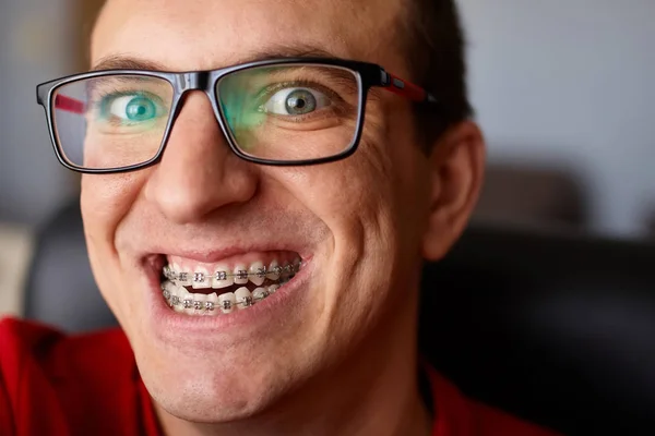 Cara Louca Cara Com Aparelho Nos Dentes Com Sorriso Óculos — Fotografia de Stock