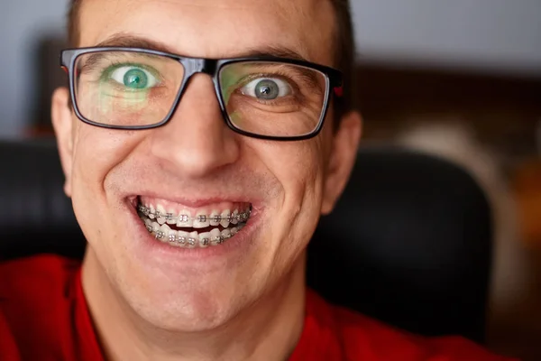 Verrücktes Gesicht Eines Typen Mit Zahnspange Lächeln Und Brille Glückliche — Stockfoto