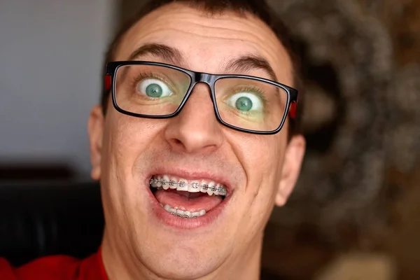 Изогнутые Зубы Парня Брекетами Очках Портрет Человека Сумасшедшее Лицо Счастливое — стоковое фото