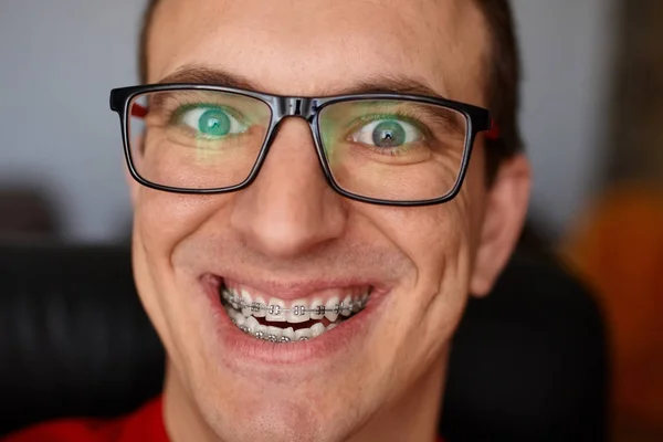 Gebogene Zähne Eines Mannes Mit Zahnspange Brille Großaufnahme Porträt Des — Stockfoto