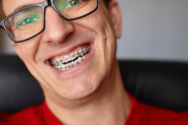 Zakřivené Zuby Chlap Složených Závorek Brýlích Zblízka Portrét Člověka Bláznivé — Stock fotografie