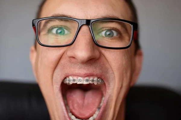 Curved teeth of guy with braces in glasses close up. Portrait of man. Crazy face. Happy expression