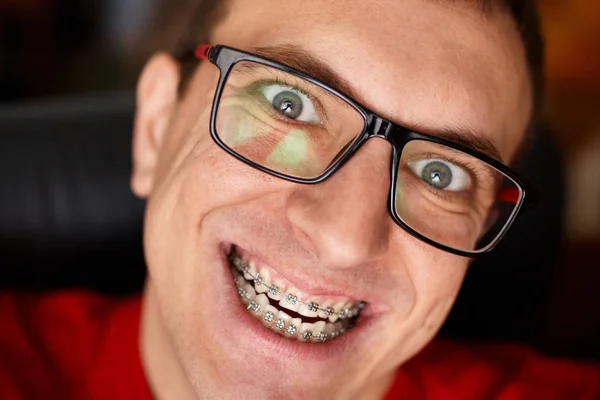 Zakrzywione Zęby Faceta Szelkami Okularach Bliska Portret Mężczyzny Szalony Twarz — Zdjęcie stockowe