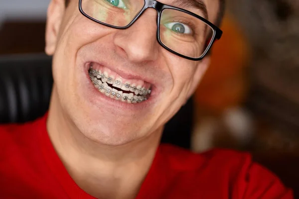 Zakrzywione Zęby Faceta Szelkami Okularach Bliska Portret Mężczyzny Szalony Twarz — Zdjęcie stockowe