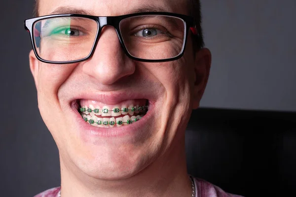 Face of a young man with metal dental braces and glasses close-up.