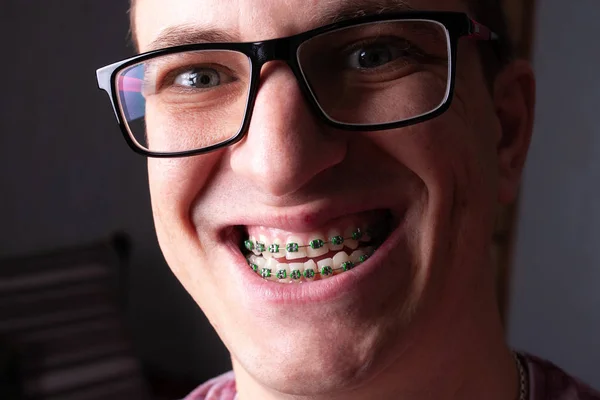 Обличчя Молодого Чоловіка Металевими Зубними Дужками Окулярами Крупним Планом — стокове фото