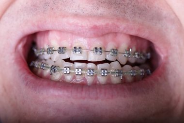 Buruşuk folyo parlak metal doku arka plan duvar kağıdı dekorasyon öğesi için kağıt ambalaj gümüş. Platin gri metalik