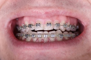 Buruşuk folyo parlak metal doku arka plan duvar kağıdı dekorasyon öğesi için kağıt ambalaj gümüş. Platin gri metalik