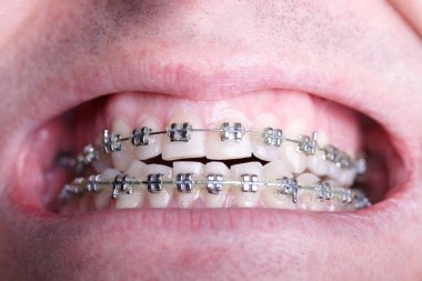 Buruşuk folyo parlak metal doku arka plan duvar kağıdı dekorasyon öğesi için kağıt ambalaj gümüş. Platin gri metalik