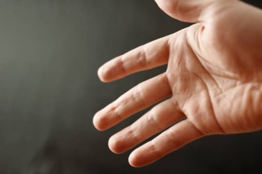 Raynaud Sendromu - Olgu yetişkin eliyle. El ile kopya alanı ile koyu arka plan üzerinde parmak kadar kapatın