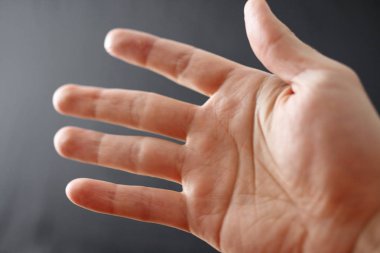 Raynaud Sendromu - Olgu yetişkin eliyle. El ile kopya alanı ile koyu arka plan üzerinde parmak kadar kapatın