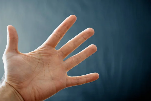 Adult Hand Raynaud Syndrome Phenomenon Закройте Руку Пальцами Темном Фоне — стоковое фото