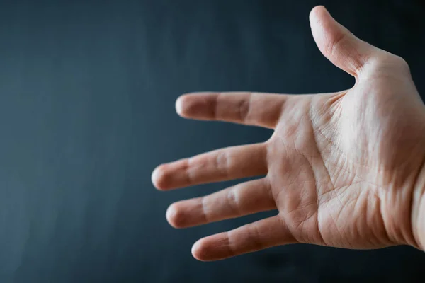 Mão Adulta Com Síndrome Raynaud Fenômeno Fechar Mão Com Dedos — Fotografia de Stock