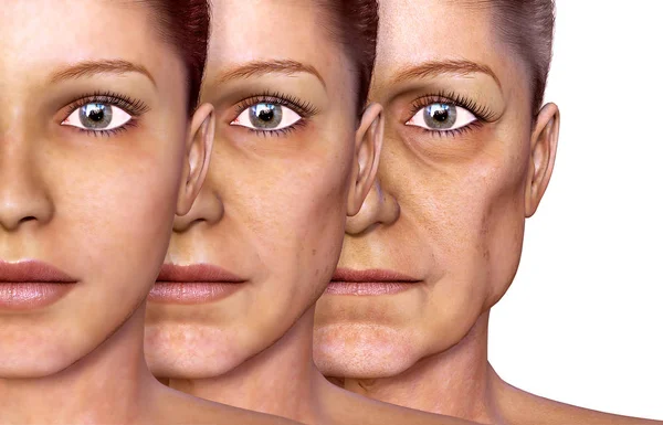 Aging of a woman, facial skin — Stock Photo, Image