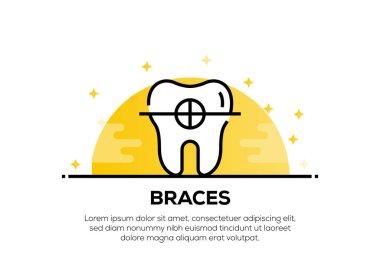 Ayraçlar Simge Kavramı, illüstrasyon 