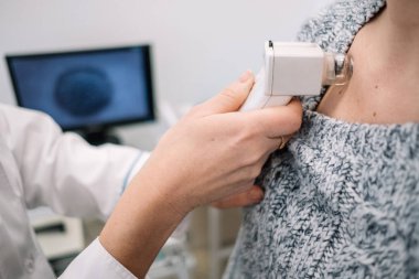 Closeup dermatolog kadınların köstebek kamera kliniği ile joystic tarafından inceleniyor. Köstebek Bankamatik monitörde Tarih closeup