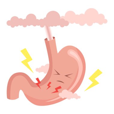 Mide ekşimesi vektör Illustration. Gastrit ve asit reflü, hazımsızlık ve mide ağrı sorunları