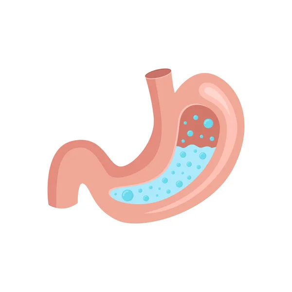 Zayıf Mide Vektör Illüstrasyon — Stok Vektör