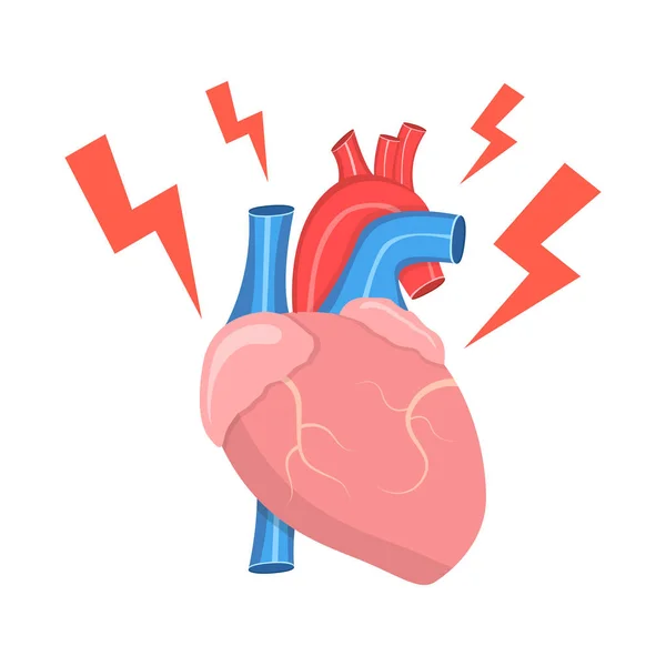 Ilustración Vectorial Del Corazón Humano Débil — Archivo Imágenes Vectoriales