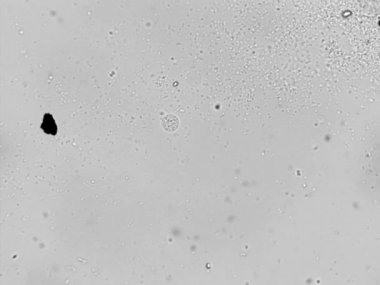 Photomicroscopy bakteriyel Atıksu Arıtma bölgeden aktif çamur