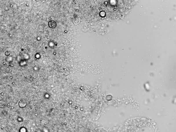 Photomikroskopie von Belebtschlamm aus der bakteriellen Abwasserbehandlungszone — Stockvideo