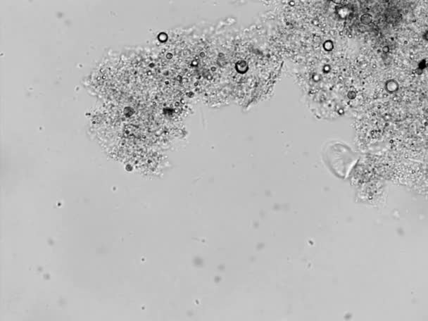 Mikrofotografie aktivovaného kalu z oblasti léčby bakteriální odpadních vod — Stock video