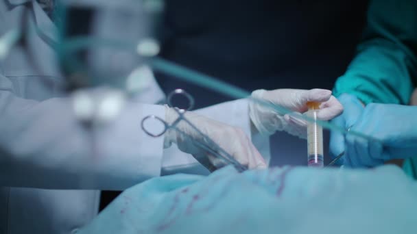 Cirujanos operando. Procedimiento de anestesia. Operación médica. Trabajo en equipo quirúrgico — Vídeo de stock