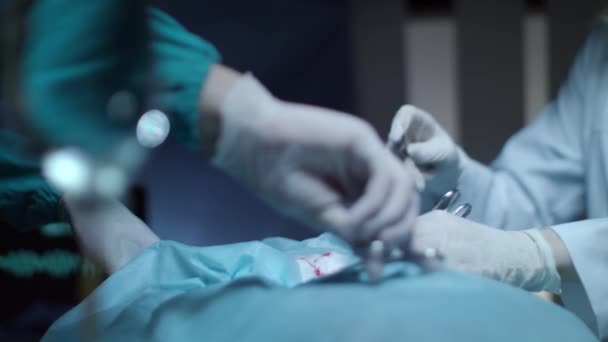 Operazione chirurgica. Chirurgia mano con strumento medico. Operatori chirurghi — Video Stock