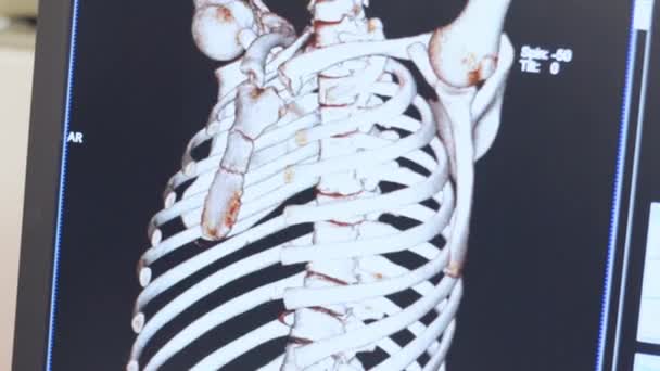 Magnetische resonantie beeldvorming van menselijk skelet tentoongesteld — Stockvideo
