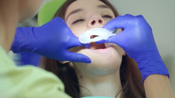 Tandarts voorbereiding patiënt mondholte voor teeth whitening procedure — Stockvideo