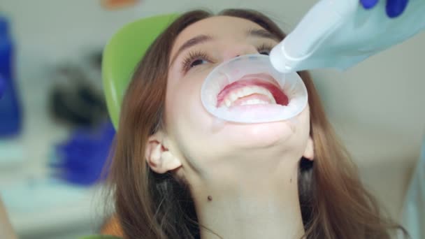 Paciente en procedimiento de blanqueamiento dental en clínica dental. El doctor enciende la luz — Vídeos de Stock