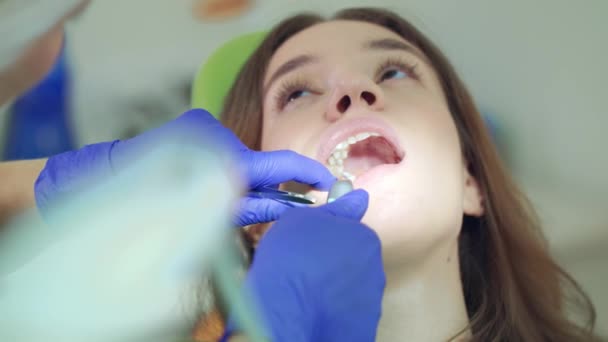 在家庭牙医中治疗牙齿的妇女。牙医手工作在妇女嘴 — 图库视频影像