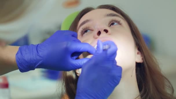 Женщина-дантист вытаскивает хлопковый тампон из открытого рта пациента — стоковое видео