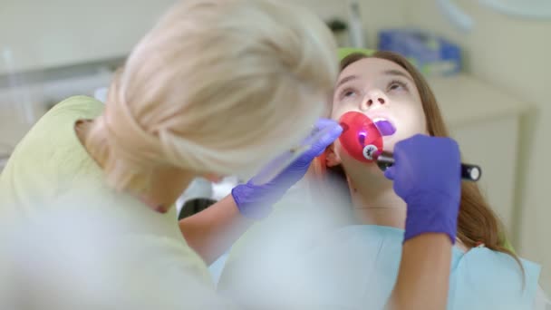 Dentista que trabaja con lámpara de polimerización dental en cavidad oral. Tratamiento dental — Vídeos de Stock