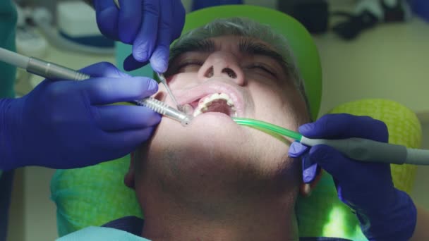 Dentista perforando el diente del paciente. Manos dentistas trabajando en cavidad oral abierta — Vídeos de Stock