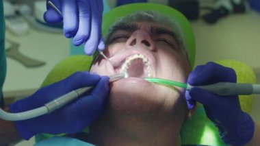 Stomatology erkek hastada kür diş hekimi. Çalışan diş hekimi eller yukarı kapatın
